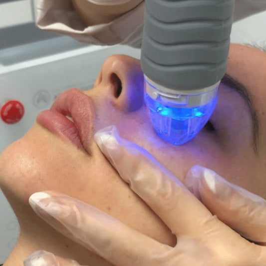 The Next Chapter - Virtue RF Microneedling