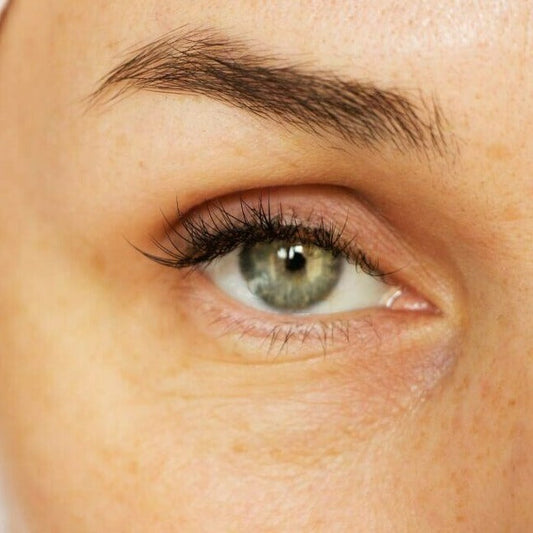 Spring Sale Event 1 - Ultherapy® Brow Lift