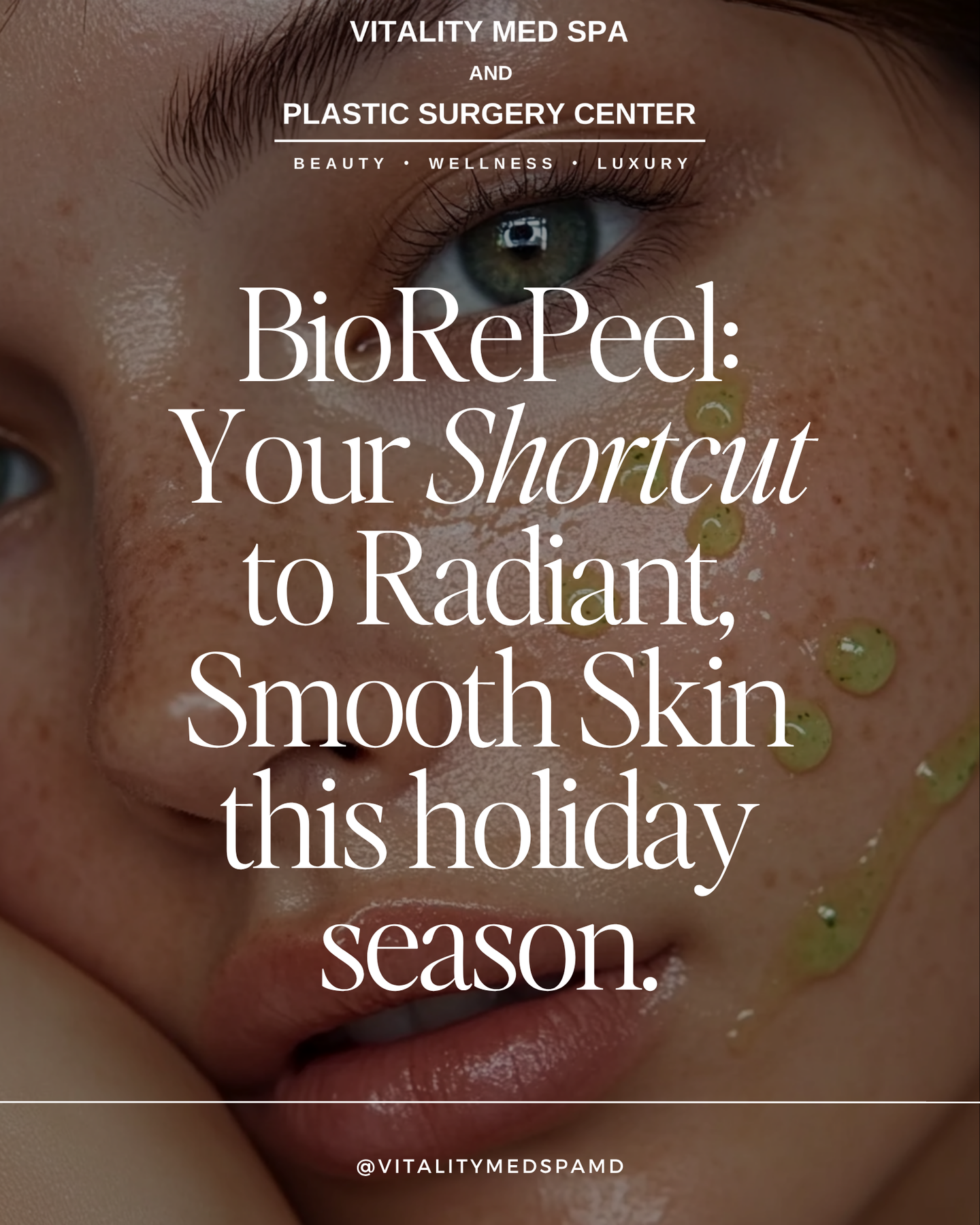Holiday Glow BioRePeel — $200 (Reg. $329)