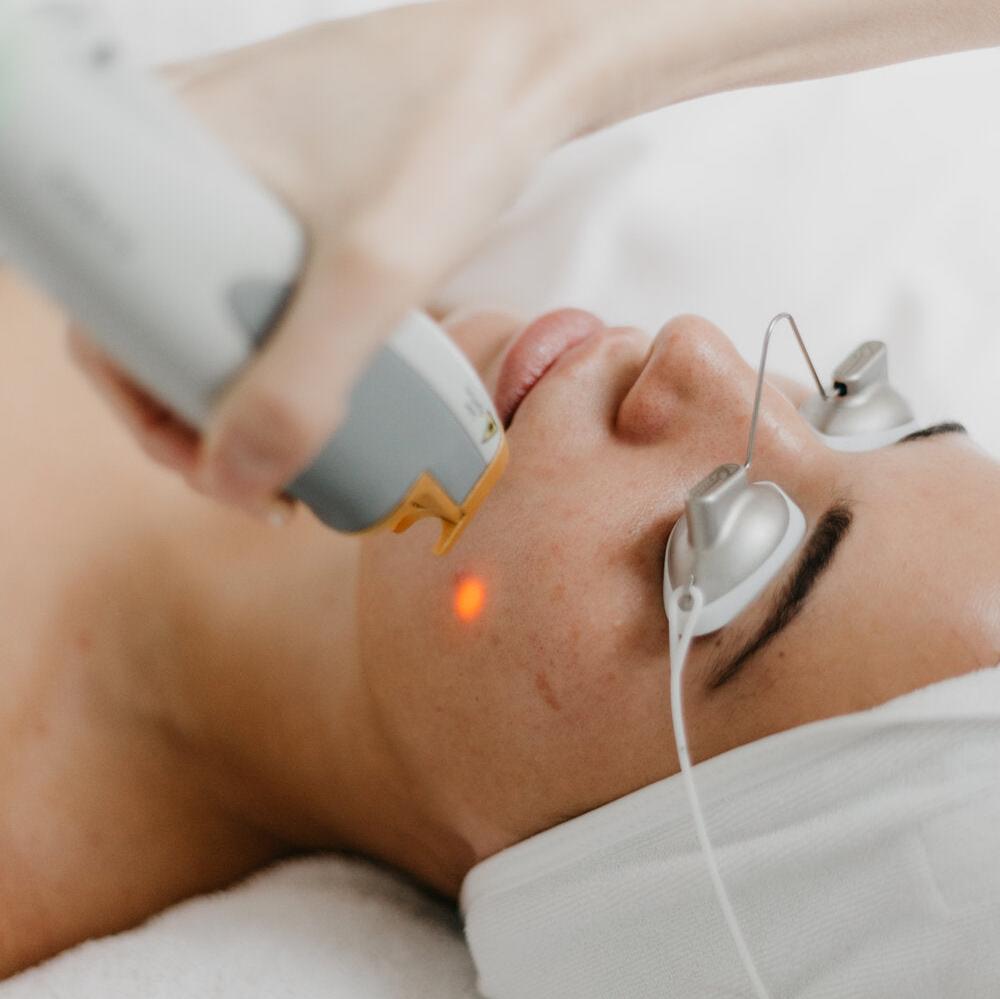 Birthday Sale - Laser Genesis Collagen Boost Facial