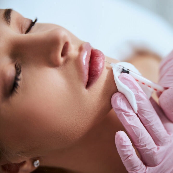 Birthday Sale - Full Lip Plump (1 Syringe Versa)