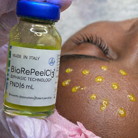 Spring Sale Event 1- BioRePeel - Little To NO downtime