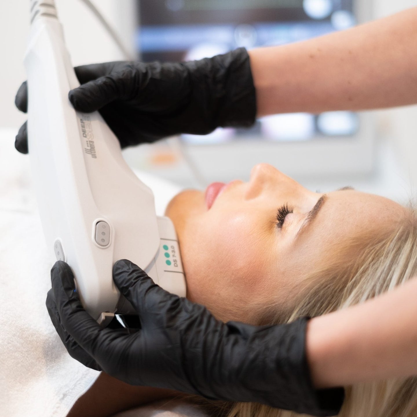 25% Off Ultherapy - Glow Full Face