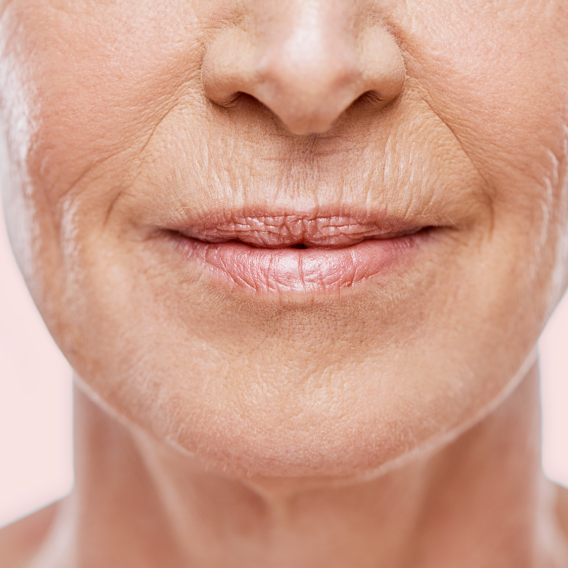 Birthday Sale BOGO - Ultherapy Skin Tightening Lip Lines