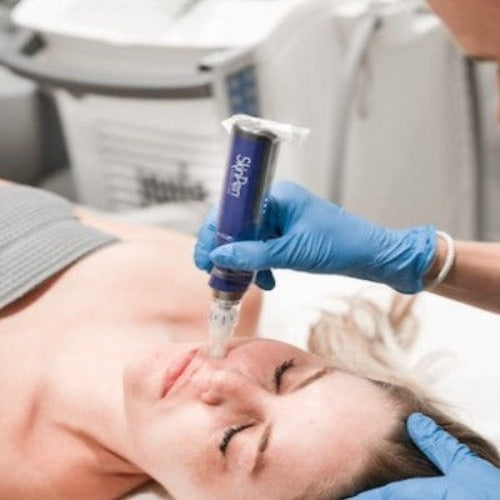 Trick Or Treatment - Microneedling Treatment