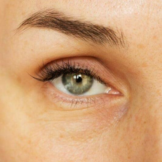 The Next Chapter Event - Ultherapy - Brow Lift